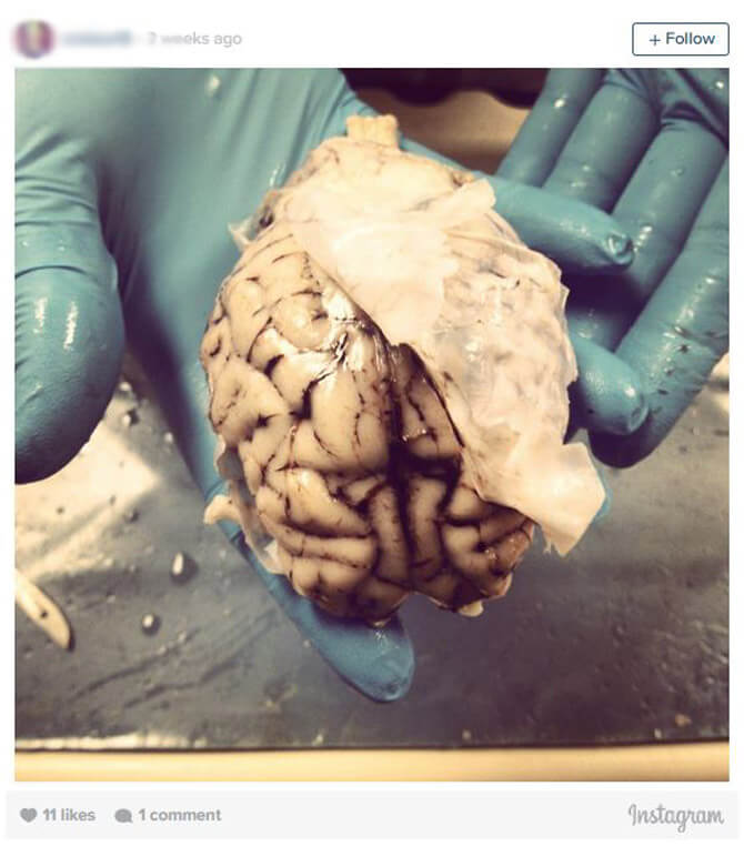 brain-2
